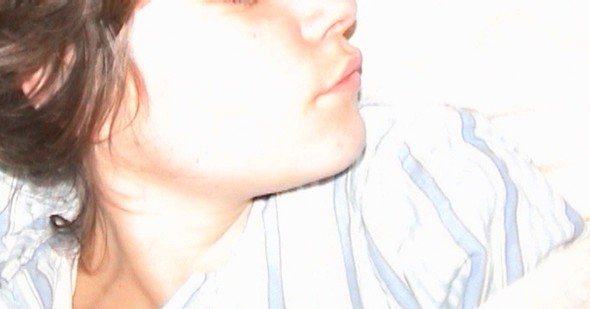 Image:3