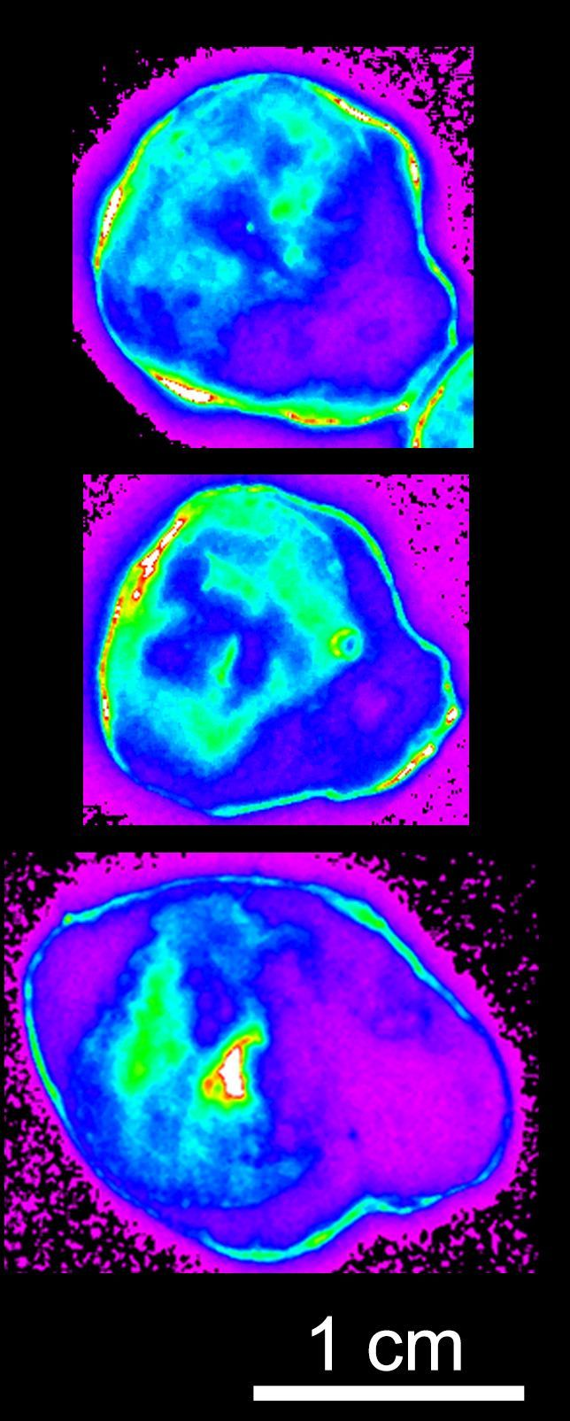 Demonstration of tumor margin illumination using a polymer probe