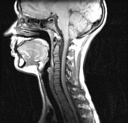 MRI – imaging v medicíně